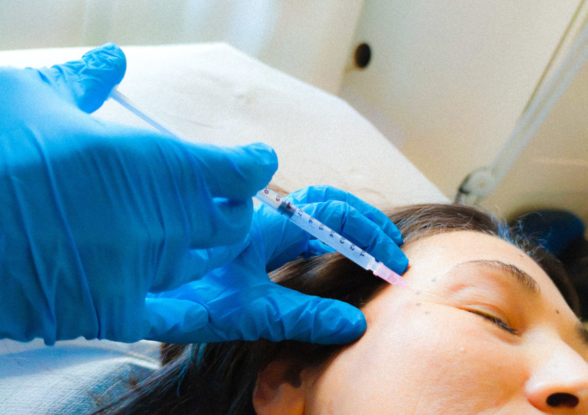 Viene effettuata una iniezione di Botox rughe viso presso Studio Vircos a Roma San Giovanni dalla Dottoressa Fantini Medico Chirurgo perfezionato in Medicina Estetica.