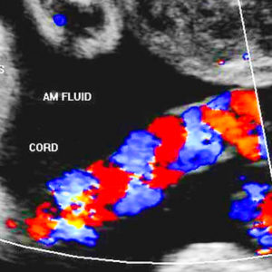 Il nostro Specialista è tra i migliori Ginecologi a Roma per l'esame della flussimetria fetale