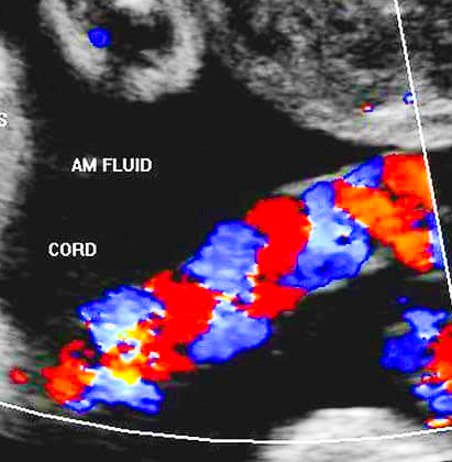 Il nostro Specialista è tra i migliori Ginecologi a Roma per l'esame della flussimetria fetale