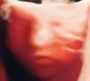 Presso il nostro Studio a Roma un Ginecologo esperto esegue l'Ecografia Morfologica