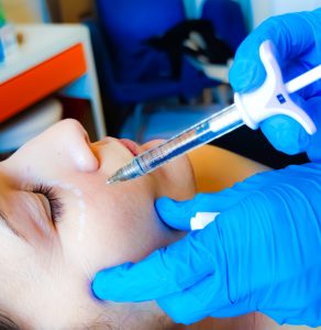 Il Filler Acido Ialuronico eseguito da quello che molti ritengono il miglior Medico Estetico Roma