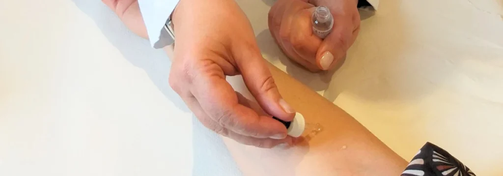 Prick test a Roma San Giovanni presso Studio Vircos