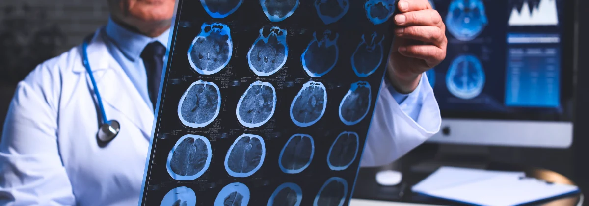 Visita neurologica a Roma San Giovanni presso Studio Vircos